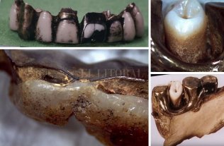 Forenses franceses aseguran haber hallado los restos de Hitler Forenses franceses aseguran haber hallado los restos de Hitler