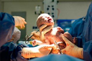 Jornada sobre violencia obstétrica Parto respetado: "Lo que veo más violado es la hora de oro" - Exceso. En el área de la salud pública, estiman que entre el 50% y el 60% de los nacimientos son por cesárea. Parto respetado: "Lo que veo más violado es la hora de oro" - Exceso. En el área de la salud pública, estiman que entre el 50% y el 60% de los nacimientos son por cesárea.