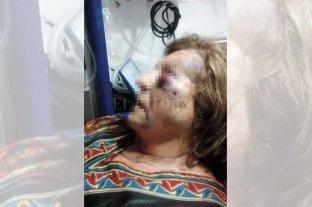 Noche de horror en Villa California Los torturaron para robarles - El rostro de Noemí refleja el infierno sufrido; no conformes, los maleantes también golpearon sus rodillas. "Le pegaron más de 30 martillazos", dijo su esposo. Los torturaron para robarles - El rostro de Noemí refleja el infierno sufrido; no conformes, los maleantes también golpearon sus rodillas. "Le pegaron más de 30 martillazos", dijo su esposo.