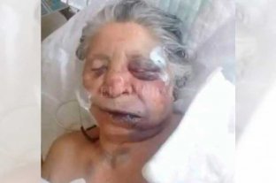 Violencia Entradera: brutal golpiza a una anciana en Reconquista - Dolores Encina permanece internada en el Hospital Central de Reconquista, en la unidad de terapia intensiva. Entradera: brutal golpiza a una anciana en Reconquista - Dolores Encina permanece internada en el Hospital Central de Reconquista, en la unidad de terapia intensiva.