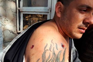 Pesadilla en barrio Belgrano "Quieren mi casa para vender drogas" - Marcos Bonnet (30) recibió un balazo que le atravesó su hombro derecho. "Quieren mi casa para vender drogas" - Marcos Bonnet (30) recibió un balazo que le atravesó su hombro derecho.