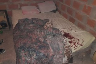 De una mordida Le arrancó una oreja a su novia y tenía condena por cortar un dedo - Después de pasar la noche fuera de su casa, Raúl Ojeda volvió y tras una discusión le arrancó la oreja a su novia, de una mordida. Le arrancó una oreja a su novia y tenía condena por cortar un dedo - Después de pasar la noche fuera de su casa, Raúl Ojeda volvió y tras una discusión le arrancó la oreja a su novia, de una mordida.