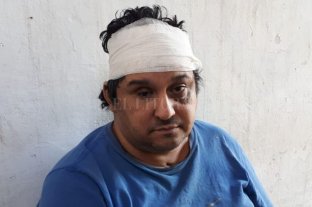 En Avenida Galicia 1700 Violento asalto en María Selva - El dueño de casa recibió varios "culatazos" que le provocaron heridas cortantes en su cabeza. Crédito: Danilo Chiapello Violento asalto en María Selva - El dueño de casa recibió varios "culatazos" que le provocaron heridas cortantes en su cabeza. Crédito: Danilo Chiapello