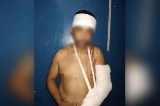 Se quería llevar a uno de los nenes Horror: la golpeó y la roció con alcohol junto a sus dos hijos recién nacidos - El agresor recibió de parte de los vecinos varios golpes que le fracturaron un brazo. Horror: la golpeó y la roció con alcohol junto a sus dos hijos recién nacidos - El agresor recibió de parte de los vecinos varios golpes que le fracturaron un brazo.