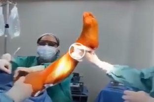 Rechazo a los dichos del Presidente Video viral: un cirujano le mostró a Alberto Fernández cómo "se relaja" - Video viral: un cirujano le mostró a Alberto Fernández cómo "se relaja" -