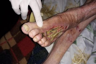 Por abandono de persona Quedó presa la dueña del geriátrico de Gálvez - Cuatro de once ancianos debieron recibir asistencia por el pésimo estado en el que se encontraban, alguno de los cuales presentaban un cuadro de desnutrición y abandono calamitoso. Quedó presa la dueña del geriátrico de Gálvez - Cuatro de once ancianos debieron recibir asistencia por el pésimo estado en el que se encontraban, alguno de los cuales presentaban un cuadro de desnutrición y abandono calamitoso.