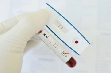 Una mujer, de la provincia de Santa Fe, se habra curado de VIH por inmunidad natural