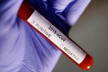 Buscan voluntarios para contraer covid en nombre de la ciencia - El tubo de ensayo con la etiqueta Coronavirus se ve en esta ilustración tomada el 29 de enero de 2020. - 
