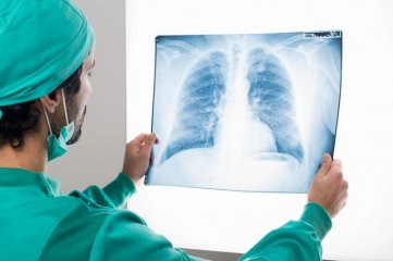 Cáncer de pulmón: aprueban una nueva droga para un subtipo de la enfermedad